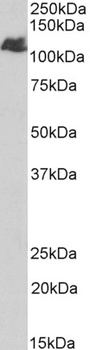 ATP5C1 Antibody