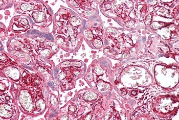 AOF2/LSD1 Antibody