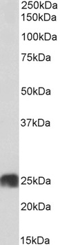 OAS2 Antibody