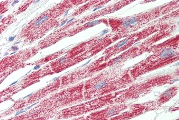 OAS2 Antibody