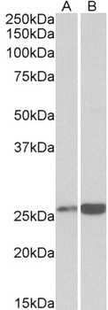 calreticulin Antibody