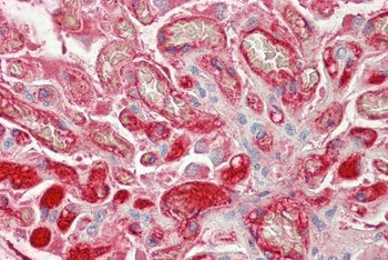 SERPINB1 Antibody