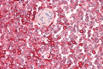 WASP Antibody