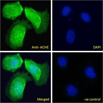 ACHE Antibody