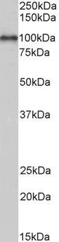 COL4A3 Antibody