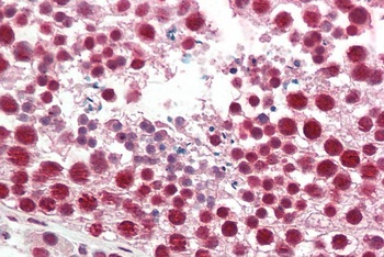 MARCH7/Axotrophin Antibody