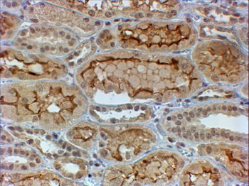 cytokeratin 19 Antibody