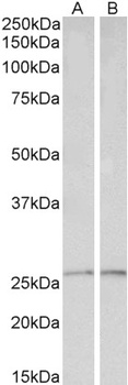 syndecan 1/CD138 Antibody