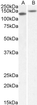 kininogen 1 Antibody