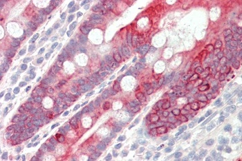 Thrombospondin Antibody