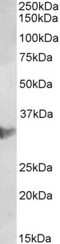 Thrombospondin Antibody