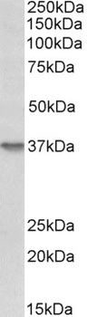 Thrombospondin Antibody