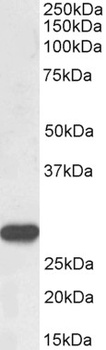 NR5A2 / LRH1 Antibody