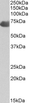 carbonic anhydrase XII Antibody