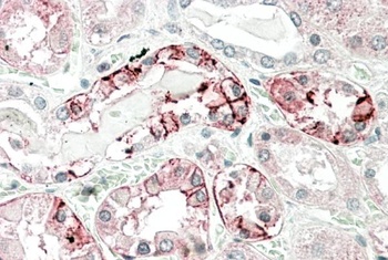 alpha-1-antitrypsin Antibody