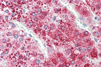 alpha-1-antitrypsin Antibody