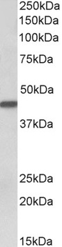 proteinase 3 / myeloblastin Antibody