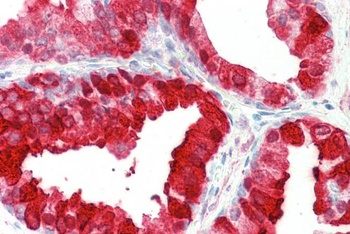 FOXF1 Antibody