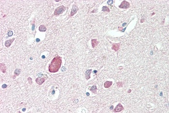 GLP1R Antibody