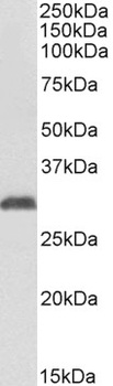 GLP1R Antibody