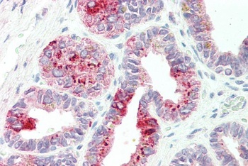 GLP1R Antibody