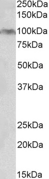 prealbumin/transthyretin Antibody