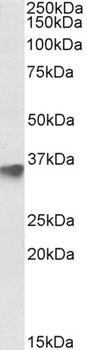 NOLC1 Antibody