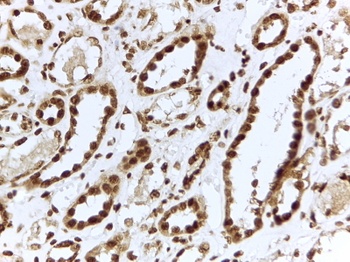 BAG3 Antibody