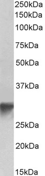 ECSM2 Antibody