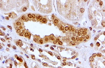 SERCA2/ATP2A2 Antibody