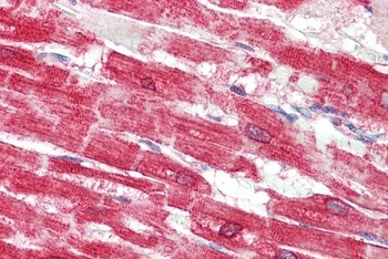 CDSN Antibody