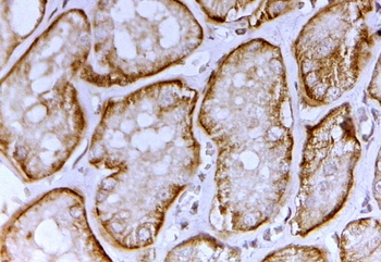 betaCstF-64 variant 1/ betaCstF-64 variant 3 Antibody
