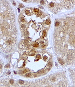 ERCC6 Antibody