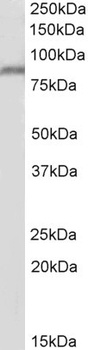 ENPP2 / AUTOTAXIN Antibody