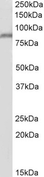 ENPP2/AUTOTAXIN Antibody