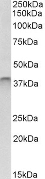 TORC2 Antibody