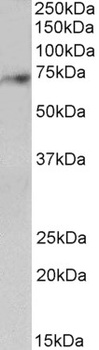 MAST3 Antibody