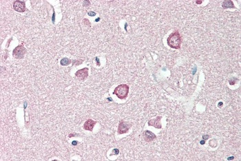 HOXC6, Antibody