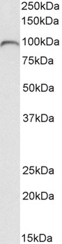 HOXA5 Antibody