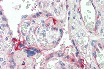 HOXA5 Antibody