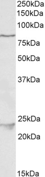 KIT / CD117 Antibody