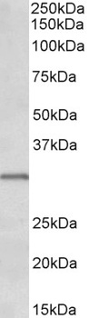 KIT / CD117 Antibody
