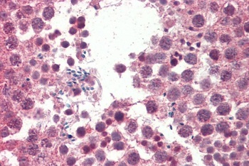 KIT / CD117 Antibody