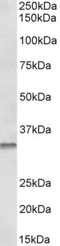 BCAR1 Antibody