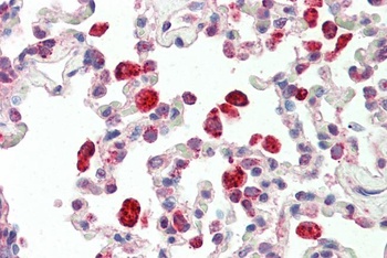 CBFB Antibody