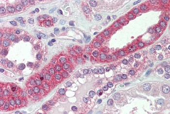 NPHS2 / SRN1 Antibody