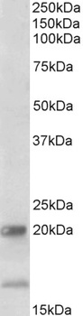 CIZ1 Antibody
