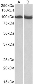 p15INK4b Antibody