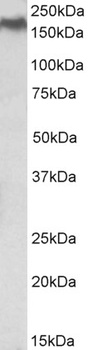 PIM2 Antibody