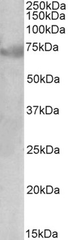 PIM2 Antibody